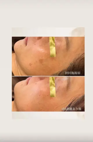 knoté 🦋Nittaのエステ・リラクイメージ