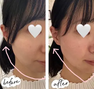 糸島 エステサロンmiuのエステ・リラクイメージ