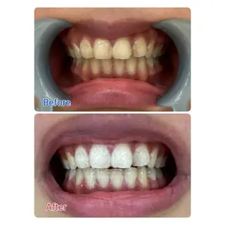 MBEAUTYSALON 千葉店・京成大久保所属・Melty 輝のその他イメージ