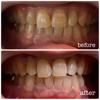 DH. MISATOの眉毛・アイブロウイメージ