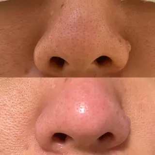 Eyelash salon MORE(モア)所属・安納 麻穂のエステ・リラクイメージ