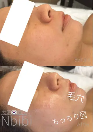 韓国🇰🇷価格 サロン_Nbibiのエステ・リラクイメージ