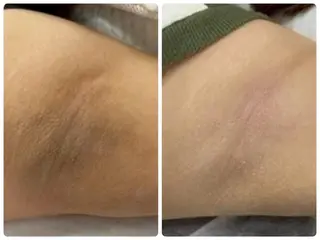 脱毛×肌管理サロン ルネルのエステ・リラクイメージ