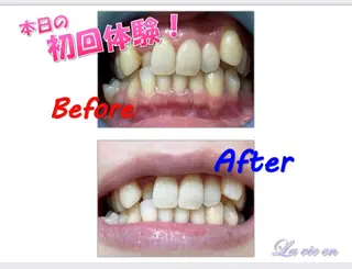 セルフホワイトニングサロン　ラヴィアン所属・ホワイトニングサロン La vie enのその他イメージ