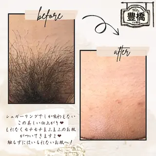 Hit. シュガーリング豊橋のエステ・リラクイメージ