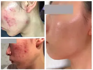 BASE Beauty Lounge所属・BASE🍯 KAORIのエステ・リラクイメージ