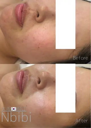 韓国🇰🇷価格 サロン_Nbibiのエステ・リラクイメージ