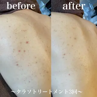 浜野 恵美のエステ・リラクイメージ