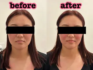 美容鍼灸Solana所属・肌質改善×美容鍼 ゆいのエステ・リラクイメージ