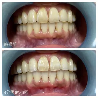 ネイル ネイル/耳つぼ /新ホワイトニングのネイルデザイン