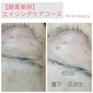 若返り 美肌   エステサロンららんのエステ・リラクイメージ