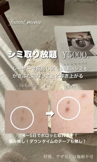 M. lisyelのエステ・リラクイメージ