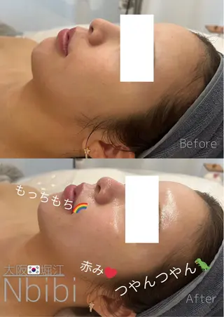 韓国🇰🇷価格 サロン_Nbibiのエステ・リラクイメージ