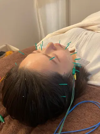 美容鍼　蒼月-aotsuki-所属・美容鍼「蒼月」 -アオツキ-のエステ・リラクイメージ