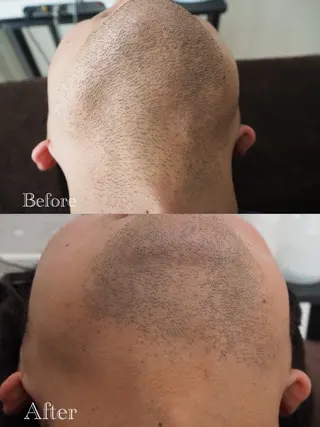 メンズ 沖 美麗のエステ・リラクイメージ