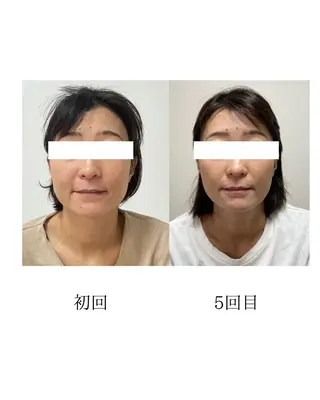 美容鍼灸サロン   colorier所属・美容鍼灸サロン colorierのエステ・リラクイメージ