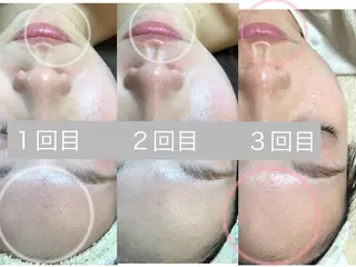 エステサロン monicoの眉毛・アイブロウイメージ