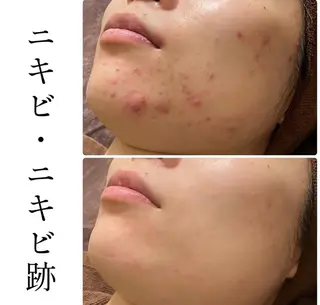 ハーブピーリング専門 BIOPLUS＋川崎のエステ・リラクイメージ