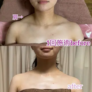 透明感の肌Lino malieのエステ・リラクイメージ