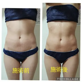 beauty salon    向日葵所属・beauty  salon 向日葵のエステ・リラクイメージ