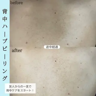 ベラージュ【美背中・ 美尻・フェイシャル】のエステ・リラクイメージ