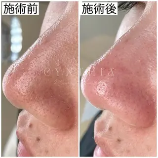 マツエク・マツパ 毛穴ケア専門店 Cynthiaのエステ・リラクイメージ