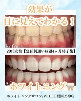 メンズ ホワイトニング専門店 WHITE天神店のエステ・リラクイメージ