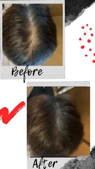 ミディアム Kanal Kanaのエステ・リラクイメージ