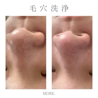 MORE. NEMAのエステ・リラクイメージ