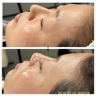 マツエク・マツパ ビューティー ミロワールのエステ・リラクイメージ