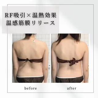 小顔矯正専門店 【RED】池田のエステ・リラクイメージ