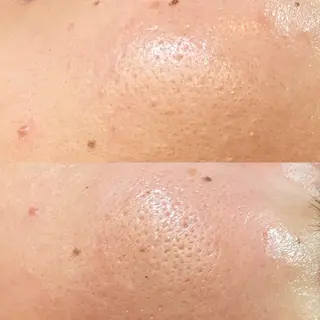 brilliance所属・老化肌トラブル肌専門 Brillianceのエステ・リラクイメージ