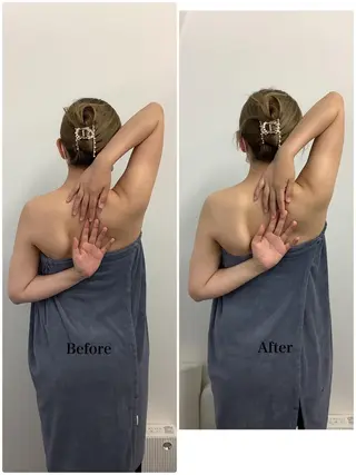 メディカルサロンドオフ所属・ハリサロンドオフ 美容鍼灸×小顔整体のエステ・リラクイメージ