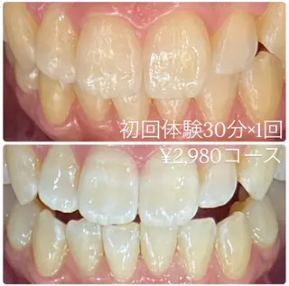 PLATINUM Beauty 横浜店所属・ホワイトニングルーム 横浜店のその他イメージ