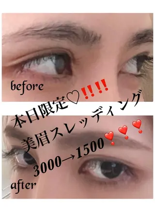 アイブロウ ハーブピーリング/韓国肌管理/フェイシャル/毛穴洗浄/眉毛/顔脱毛【糸脱毛専門】rev所属・ハーブピーリング🌹 毛穴洗浄❤️眉waxのエステ・リラクイメージ