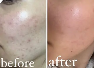 クラスペディア脱毛 ・フェイシャル専門店のエステ・リラクイメージ