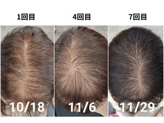 美容とカラダの鍼灸 サロン やなけんのエステ・リラクイメージ