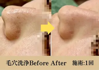 美肌脱毛サロン muroのエステ・リラクイメージ