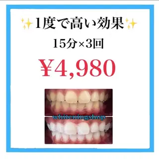 ホワイトニングショップ　高松瓦町店所属・ホワイトニング ショップ 高松瓦町のその他イメージ