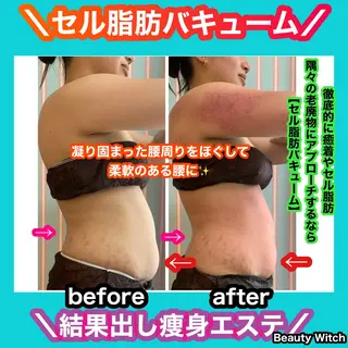 痩身/脱毛/ネイル HARUKAのエステ・リラクイメージ