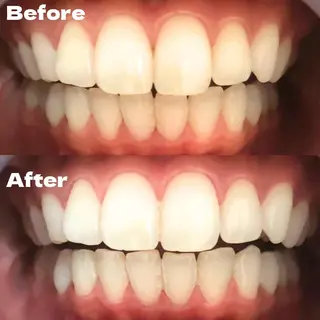 LBSホワイトニング 銀座店💎公式のその他イメージ