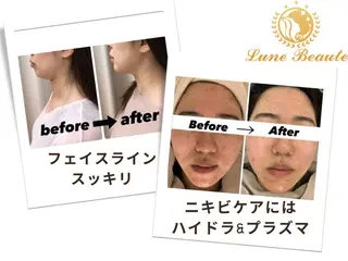 毛穴&ニキビケア 専門ルナボーテ渋谷のエステ・リラクイメージ