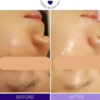 小顔＆まつ毛サロン AKANE❤️のエステ・リラクイメージ