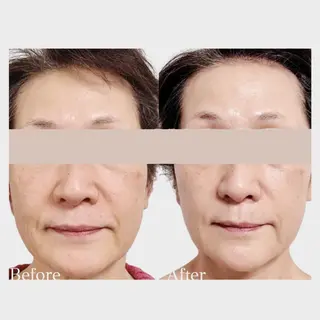 看護師 AYUIのエステ・リラクイメージ