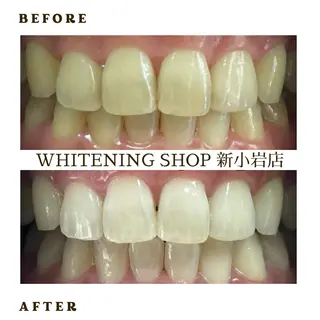 メンズ ホワイトニング ショップ新小岩店のその他イメージ