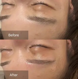 アイブロウ for woman所属・森 美優のエステ・リラクイメージ