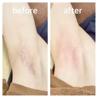 メンズ Beauty salon 十美所属・【 十美 】 ENDOのエステ・リラクイメージ