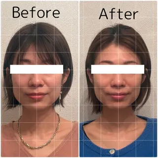 Lily luce 美骨小顔矯正のその他イメージ