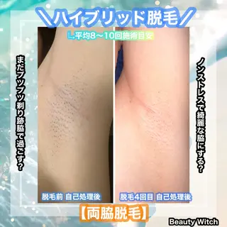 痩身/脱毛/ネイル HARUKAのエステ・リラクイメージ