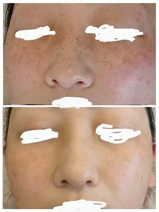 babyaiai所属・babyaiai 　momo🍑のエステ・リラクイメージ